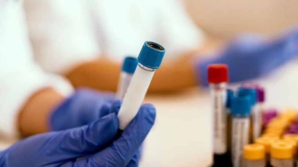 Coronavirus e test seriologici, indagati vertici San Matteo e Diasorin