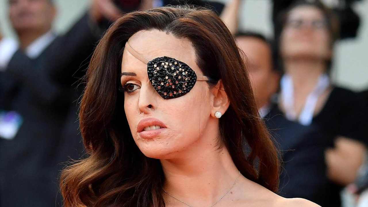 Violenza sulle donne: confermata la condanna a 15 anni per l’ex fidanzato di Jessica Notaro Violenza sulle donne: confermata la condanna a 15 anni per l’ex fidanzato di Jessica Notaro